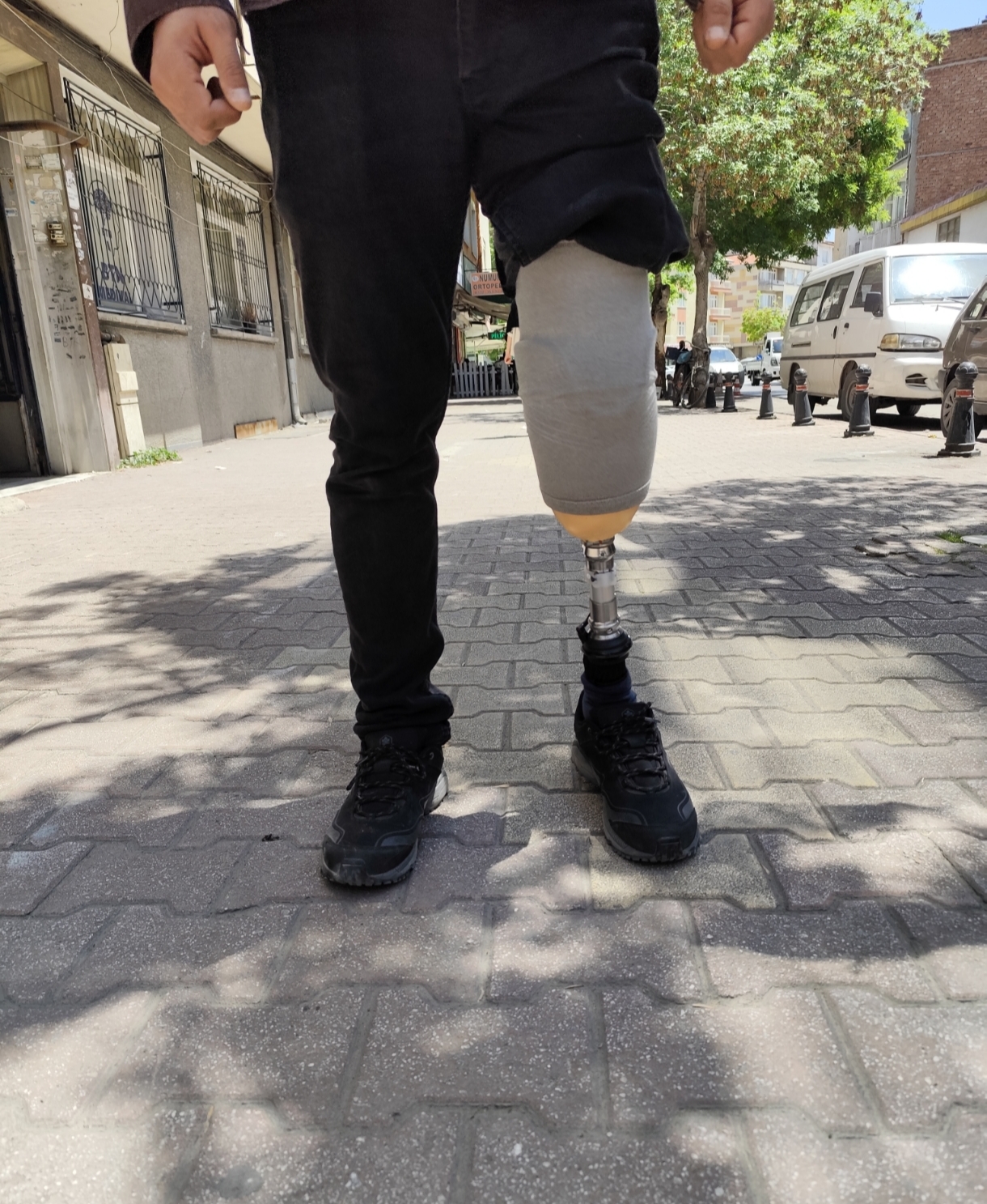 Diz Altı Protezi (Modüler)